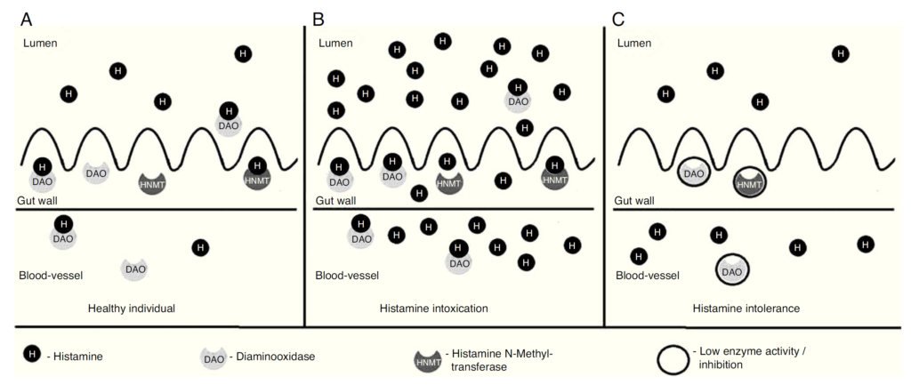 ヒスタミン不耐症の原因は何ですか?